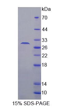 C/EBP Delta / CEBPD Protein - Recombinant CCAAT/Enhancer Binding Protein Delta (CEBPd) by SDS-PAGE