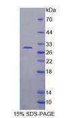 C/EBP Delta / CEBPD Protein - Recombinant CCAAT/Enhancer Binding Protein Delta (CEBPd) by SDS-PAGE