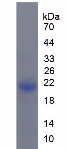 c-Kit / CD117 Protein - Recombinant Stem Cell Factor Receptor By SDS-PAGE