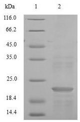 C15orf48 / NMES1 Protein - (Tris-Glycine gel) Discontinuous SDS-PAGE (reduced) with 5% enrichment gel and 15% separation gel.