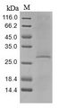 C1QTNF3 / CTRP3 Protein - (Tris-Glycine gel) Discontinuous SDS-PAGE (reduced) with 5% enrichment gel and 15% separation gel.