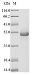 C1QTNF3 / CTRP3 Protein - (Tris-Glycine gel) Discontinuous SDS-PAGE (reduced) with 5% enrichment gel and 15% separation gel.