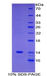 C4BPA / C4BP Alpha Protein - Recombinant C4 Binding Protein Alpha By SDS-PAGE