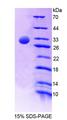 C4BPA / C4BP Alpha Protein - Recombinant C4 Binding Protein Alpha By SDS-PAGE