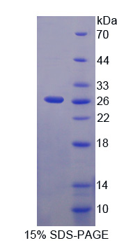 C6orf150 / MB21D1 Protein - Recombinant  Mab21 Domain Containing Protein 1 By SDS-PAGE