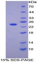 CA1 / Carbonic Anhydrase I Protein - Recombinant Carbonic Anhydrase I By SDS-PAGE