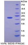 CA1 / Carbonic Anhydrase I Protein - Recombinant Carbonic Anhydrase I By SDS-PAGE