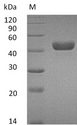 CA14 / Carbonic Anhydrase XIV Protein - (Tris-Glycine gel) Discontinuous SDS-PAGE (reduced) with 5% enrichment gel and 15% separation gel.