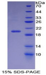 CA6 / Carbonic Anhydrase 6 Protein - Recombinant Carbonic Anhydrase VI By SDS-PAGE