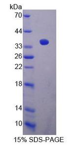 CABIN1 Protein - Recombinant Calcineurin Binding Protein 1 By SDS-PAGE