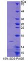 CABP2 Protein - Recombinant Calcium Binding Protein 2 (CABP2) by SDS-PAGE