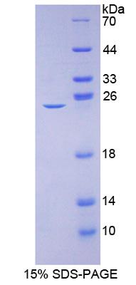 CACNA1C / Cav1.2 Protein - Recombinant Calcium Channel, Voltage Dependent, L-Type, Alpha 1C Subunit By SDS-PAGE