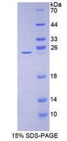 CACNA1C / Cav1.2 Protein - Recombinant Calcium Channel, Voltage Dependent, L-Type, Alpha 1C Subunit By SDS-PAGE