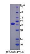 CACNA1S / Cav1.1 Protein - Recombinant Calcium Channel, Voltage Dependent, L-Type, Alpha 1S Subunit By SDS-PAGE