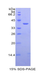 Calcitonin Protein - Recombinant Calcitonin By SDS-PAGE