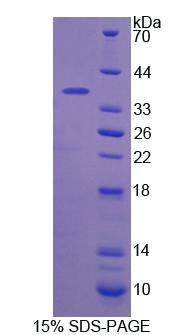 CANT1 Protein - Recombinant Calcium Activated Nucleotidase 1 By SDS-PAGE