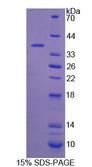 CANT1 Protein - Recombinant Calcium Activated Nucleotidase 1 By SDS-PAGE
