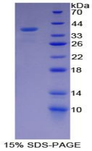 CAPN1 / Calpain 1 Protein - Recombinant Calpain 1, Large Subunit By SDS-PAGE