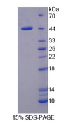 CAPN10 / Calpain 10 Protein - Recombinant Calpain 10 By SDS-PAGE