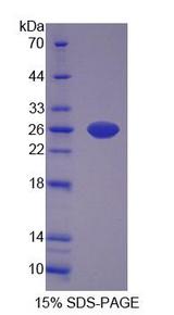 CARNS1 Protein - Recombinant  Carnosine Synthase 1 By SDS-PAGE