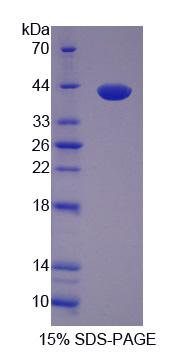 CARP / ANKRD1 Protein - Recombinant  Ankyrin Repeat Domain Protein 1 By SDS-PAGE