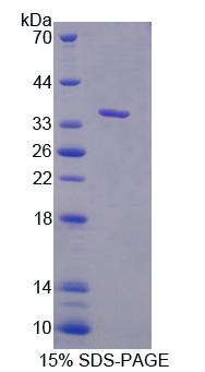 CASC1 Protein - Recombinant Cancer Susceptibility Candidate 1 (CASC1) by SDS-PAGE