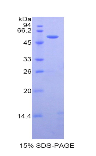 CASP14 / Caspase 14 Protein - Recombinant Caspase 14 By SDS-PAGE