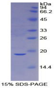 CASP2 / Caspase 2 Protein - Recombinant Caspase 2 By SDS-PAGE