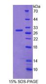 CBFB Protein - Recombinant Core Binding Factor Beta Subunit By SDS-PAGE