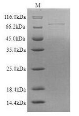 CBLN3 / Cerebellin 3 Protein - (Tris-Glycine gel) Discontinuous SDS-PAGE (reduced) with 5% enrichment gel and 15% separation gel.