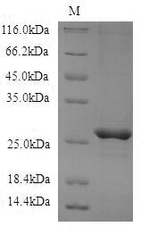 CBLN3 / Cerebellin 3 Protein - (Tris-Glycine gel) Discontinuous SDS-PAGE (reduced) with 5% enrichment gel and 15% separation gel.