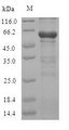 CBS Protein - (Tris-Glycine gel) Discontinuous SDS-PAGE (reduced) with 5% enrichment gel and 15% separation gel.