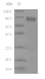 CBS Protein - (Tris-Glycine gel) Discontinuous SDS-PAGE (reduced) with 5% enrichment gel and 15% separation gel.