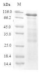 CBS Protein - (Tris-Glycine gel) Discontinuous SDS-PAGE (reduced) with 5% enrichment gel and 15% separation gel.