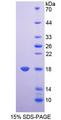 CBT1 / SDHD Protein - Recombinant  Succinate Dehydrogenase Complex Subunit D By SDS-PAGE
