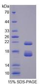 CBY1 / PGEA1 Protein - Recombinant Chibby Homolog 1 (CBY1) by SDS-PAGE