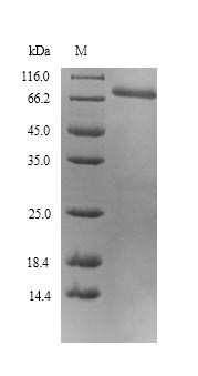 CCK4 / PTK7 Protein - (Tris-Glycine gel) Discontinuous SDS-PAGE (reduced) with 5% enrichment gel and 15% separation gel.