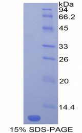 Ccl12 / MCP5 Protein - Recombinant Monocyte Chemotactic Protein 5 By SDS-PAGE