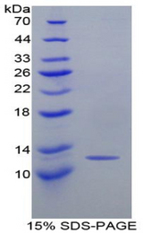CCL2 / MCP1 Protein - Recombinant Monocyte Chemotactic Protein 1 By SDS-PAGE