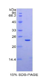 CCL4 / MIP-1 Beta Protein - Recombinant Macrophage Inflammatory Protein 1 Beta By SDS-PAGE