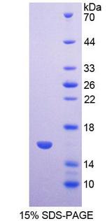 CCN4 / WISP1 Protein - Recombinant  WNT1 Inducible Signaling Pathway Protein 1 By SDS-PAGE