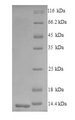 CCR5 Protein - (Tris-Glycine gel) Discontinuous SDS-PAGE (reduced) with 5% enrichment gel and 15% separation gel.