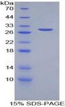 CD119 / IFNGR1 Protein - Recombinant Interferon Gamma Receptor 1 (IFNgR1) by SDS-PAGE