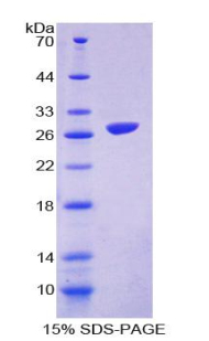 CD135 / FLT3 Protein - Recombinant  FMS Like Tyrosine Kinase 3 By SDS-PAGE