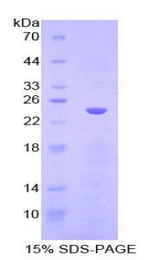 CD144 / CDH5 / VE Cadherin Protein - Recombinant Cadherin 5 By SDS-PAGE