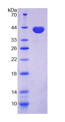 CD144 / CDH5 / VE Cadherin Protein - Recombinant  Cadherin 5 By SDS-PAGE