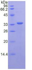 CD163 Protein - Recombinant Cluster Of Differentiation By SDS-PAGE