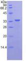 CD163 Protein - Recombinant Cluster Of Differentiation By SDS-PAGE