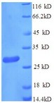 CD163 Protein