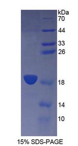 CD164 Protein - Recombinant  Cluster Of Differentiation 164 By SDS-PAGE